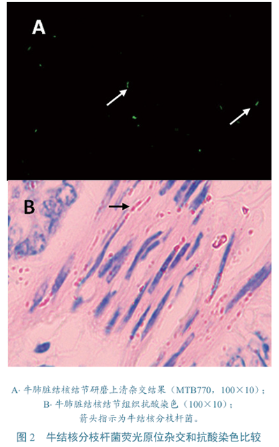 牛结核分枝杆菌检测图